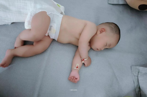 黑河六个月宝宝眼睛散光